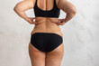 © Юля Бурмистрова - Cropped rearview of fat, adipose, overweight female body in black underwear, checking and holding excess folds, sides on back under shoulder blade. Cellulite friable skin problem. Turgor collagen loss