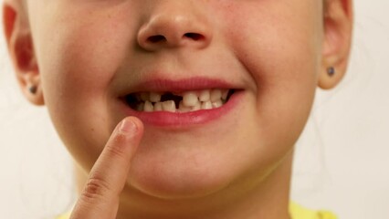 Wall Mural - Little funny girl wide smile, point finger at gap in mouth from fallen tooth and turning head closeup, white background. Face of joyful toothless child. Concept of healthy teeth and beautiful smile.