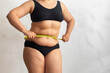 © Юля Бурмистрова - Cropped obese overweight woman with big cellulite sagging abdomen, measuring circumference of waist, belly with yellow roulette tape. Checking size before liposuction surgery. Show off adipose body