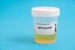 Methadone. Methadone toxicology screen urine tests for doping and drugs