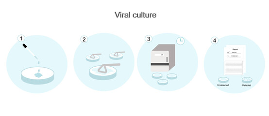 Poster - The methodology of Microbiological culture with spread plate technique to detect the Microorganism (virus, bacteria, fungus, etc.) for diagnosis or research