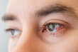 Close-up of male brown eyes with redness and burst vessels. The concept of ophthalmology and irritation from lenses