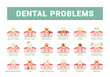 dental problems. infografic template with damaged teeth and bad oral breath. Vector flat pictures set