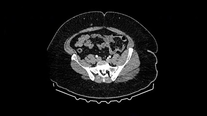 Wall Mural - Magnetic resonance radiologist visualization, MRI scan on screen computer of human illness analysis