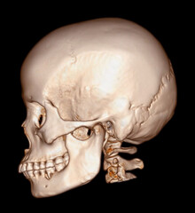 Poster - Skull 3D from CT Scan of facial bone 3D rendering showng human skull