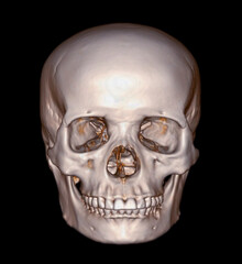 Poster - Skull 3D from CT Scan of facial bone 3D rendering showng human skull