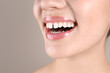 © New Africa - Woman with diastema between upper front teeth on light grey background, closeup