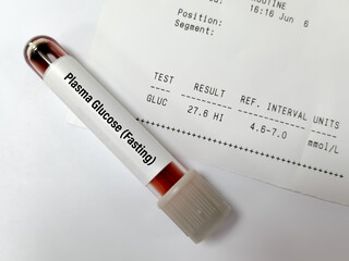 Wall Mural - Sample tube of Plasma glucose Fasting test with abnormal report called hyperglycemia.