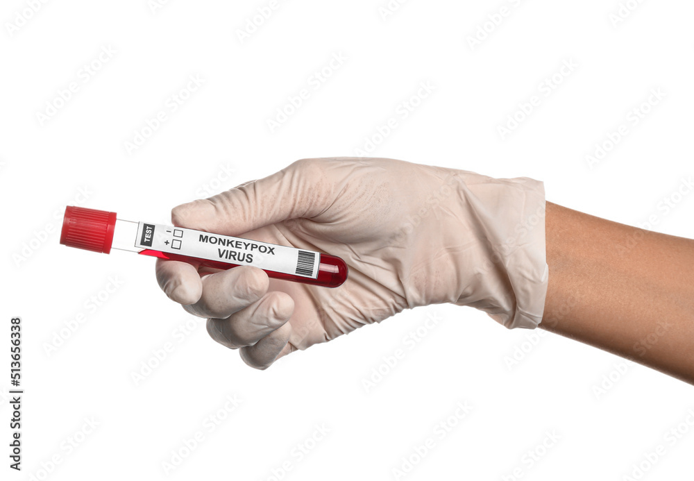 Female doctor with blood sample on white background. Monkeypox virus