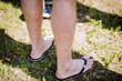 Red dots on human legs, bites of small blood-sucking insects, damage to the skin, itching and irritation of blisters, midge bite, pain in the legs.