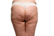 © vladimirfloyd - Overweight woman with fat cellulite legs and buttocks, obesity female body, white background
