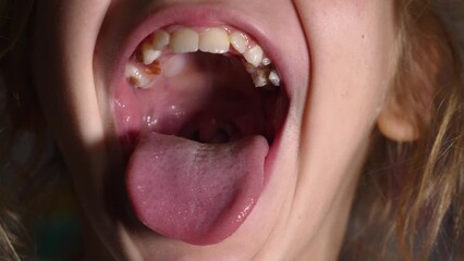 the girl opens her mouth wide and sticks out her long tongue. child shows her teeth and soft palate.