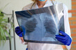 Doctor holding x-ray photograph of lungs in hands