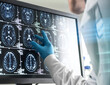 © Connect Images - Doctor analyzing patients brain scan on screen
