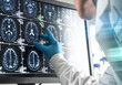 © Connect Images - Doctor analyzing patients brain scan on screen
