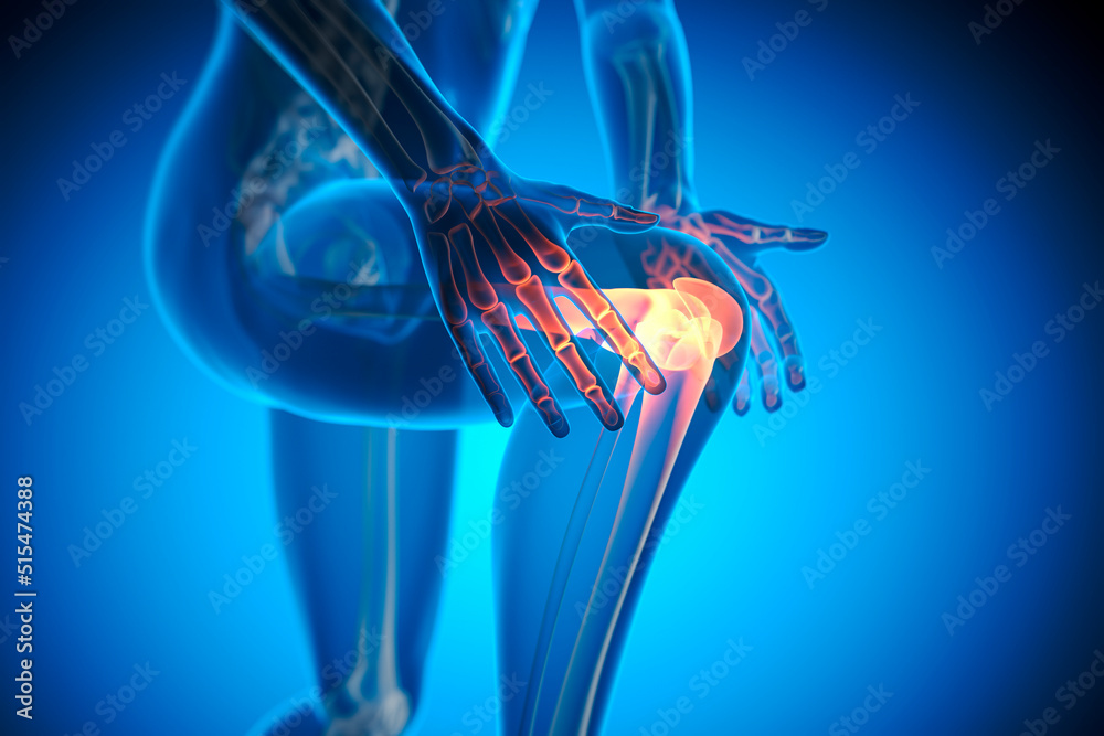 Pain in knee joint - 3D illustration Stock Illustration | Adobe Stock