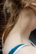 © ausra - Small mole or beauty spot on the neck of a young woman.