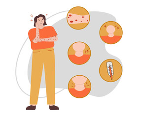 Monkeypox virus symptom infographic on human, flat design. Patient and symptoms.  Vector illustration for informing of orthopoxvirus outbreak, monkeypox virus, epidemic virus, skin infections. 