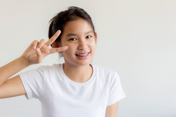 portrait of asian woman face with colorful braces and smile happily