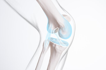 knee ligament and meniscus, human leg, medically accurate representation of an arthritic knee joint