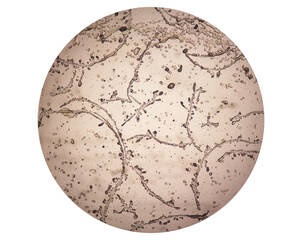 Sticker - photomicrograph of dermatophytes, skin scraping for fungus test