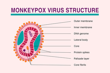 Monkeypox virus structure infographic. Disease caused by virus infection. Medical article vector illustration or news banner.