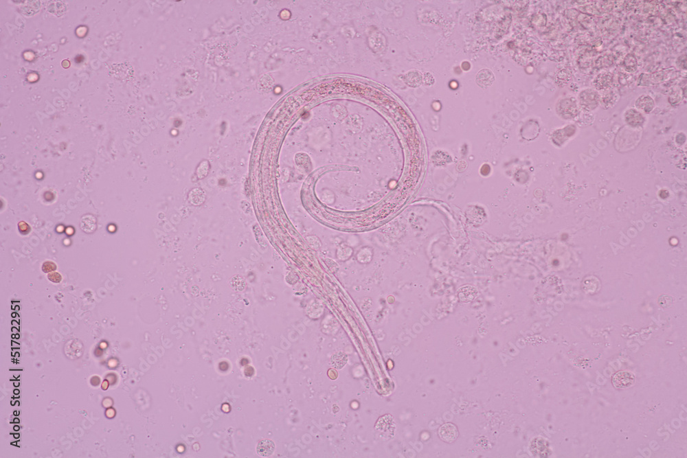 Foto de Stock View in microscopic Strongyloides stercoralis or