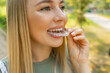 © Ivan - Dental Treatment Concept. Close up of young woman holding invisible aligner, whitening tray, free space
