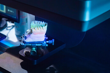 Plaster model of the prosthesis. Dental prosthetics. Orthodontics and dental treatment. A dental prosthesis. A model of the jaw in striped lighting. Production of dentures. Model of the human jaw.