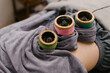 © Nabi Tang/Stocksy - Moxibustion