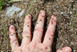hand of the person covered with many ants that bite to defend their anthill from the aggressor