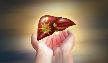 Wall Mural - Woman and illustration of unhealthy liver on color background. Viral hepatitis