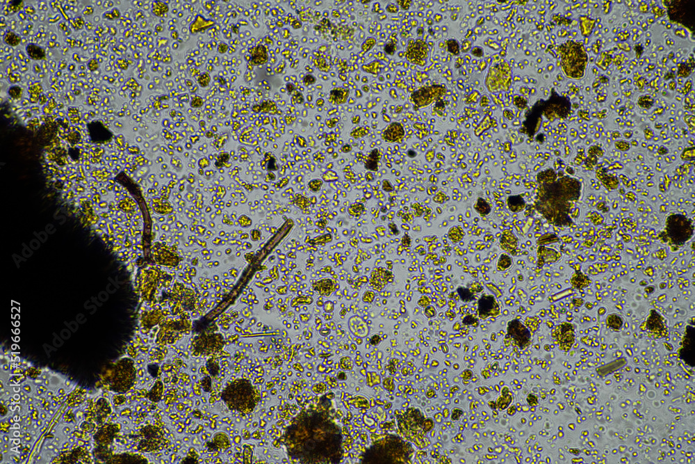 soil microbes organisms in a soil and compost sample, testate amoebae ...