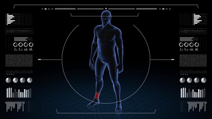 man with pathology. 3d body of boy. male human figure.