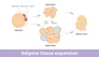 Adipose tissue expansion. Mechanisms of adipose tissue expansion: hypertrophic and hyperplasic adipose. Hypertrophic and hyperplasic fat cells in fat tissue.
