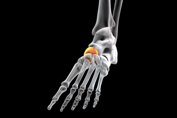 Poster - Human foot anatomy. Navicular bone of the foot