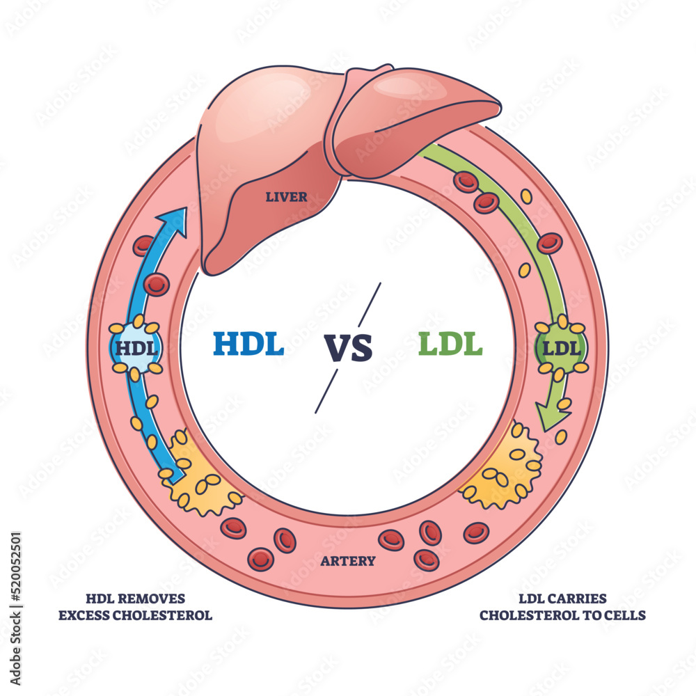 Good hdl and bad ldl cholesterol movement comparison outline diagram