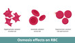 Osmosis effect on red blood cells. Depending on solution concentration (hyperosmotic, isosmotic, or hypoosmotic), erythrocytes can shrivel or swell and burst.