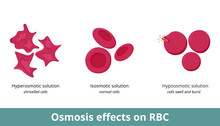 Osmosis Effect On Red Blood Cells. Depending On Solution Concentration (hyperosmotic, Isosmotic, Or Hypoosmotic), Erythrocytes Can Shrivel Or Swell And Burst.