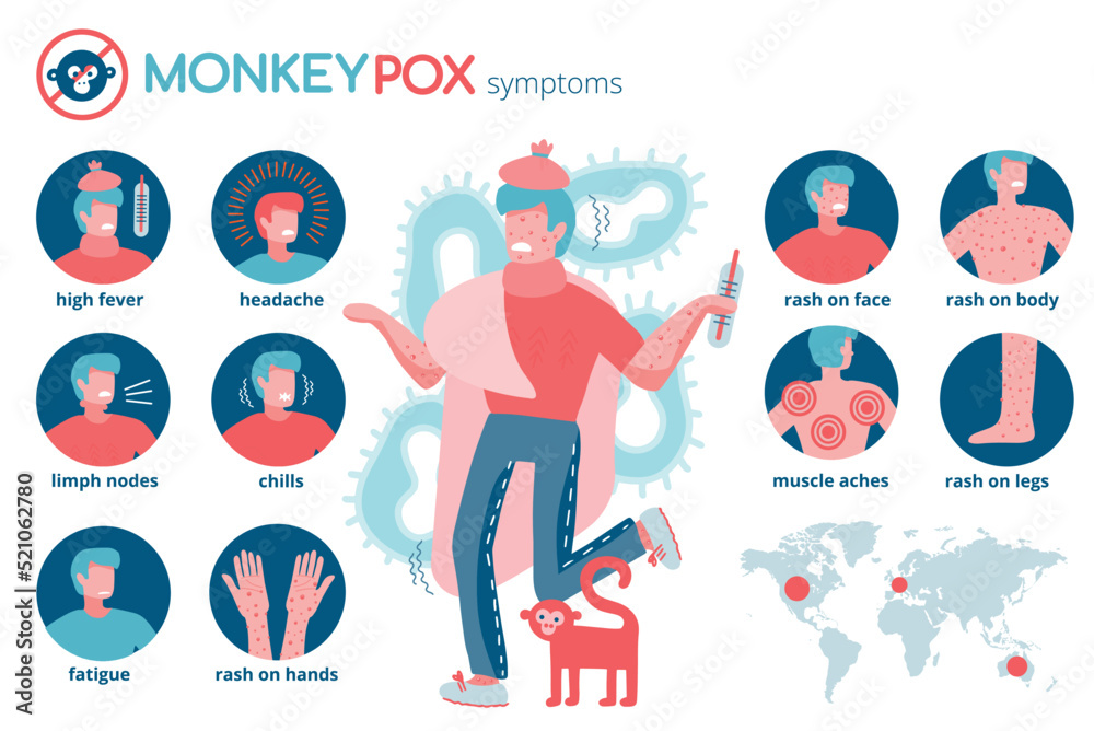 Symptoms infographic concept of monkeypox virus 2022. The man is sick ...