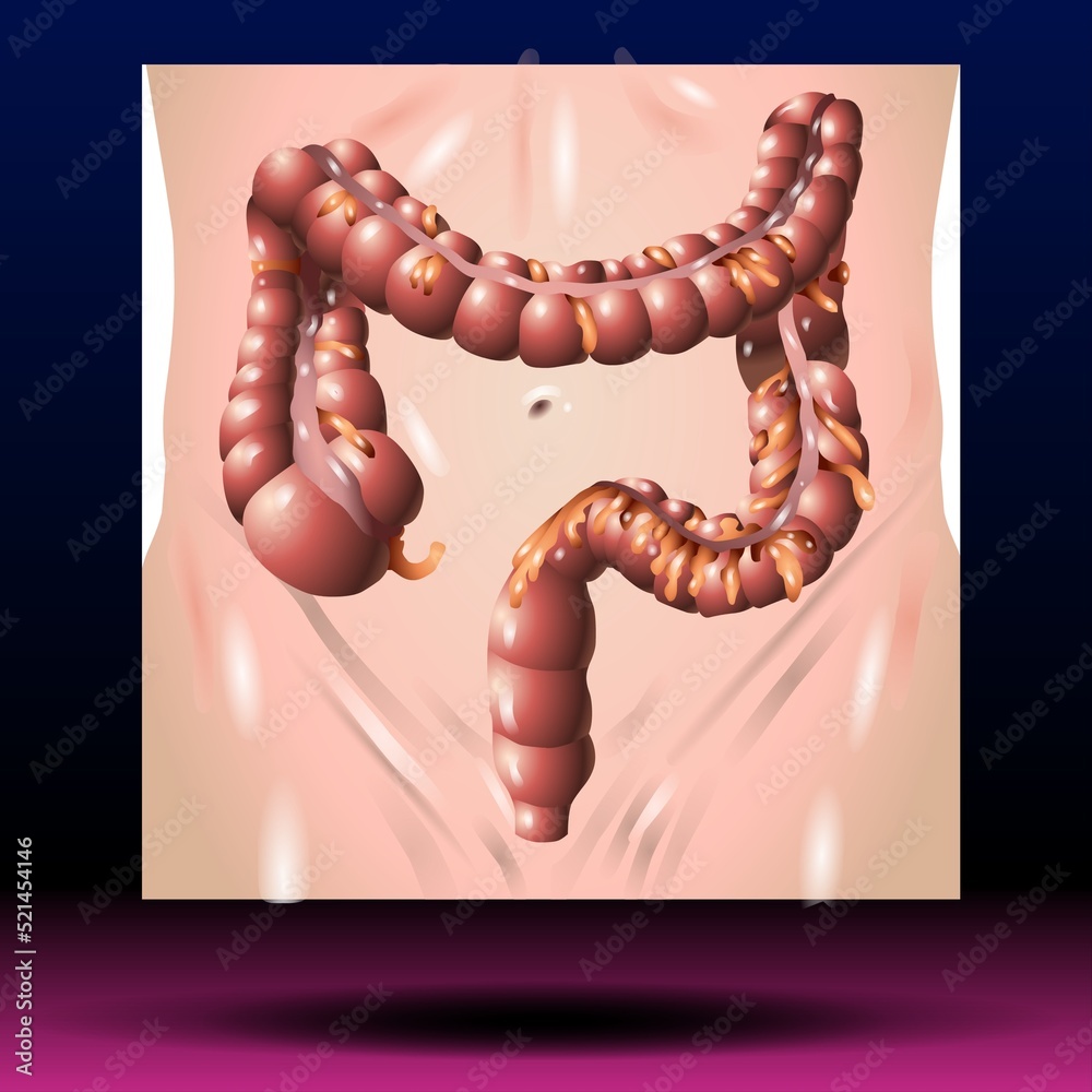 Anatomy of the Large Intestine colon Stock Illustration | Adobe Stock