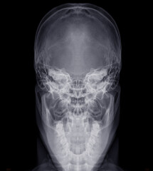 Poster - skull towne's view .