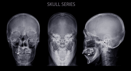Poster - skull skull series