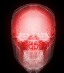 Poster -  Skull x-ray image of Human front view.
