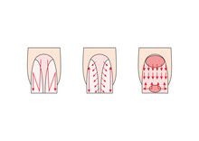 Manicure Instruction. Nails Vector Illustrations. Lady Fingers.