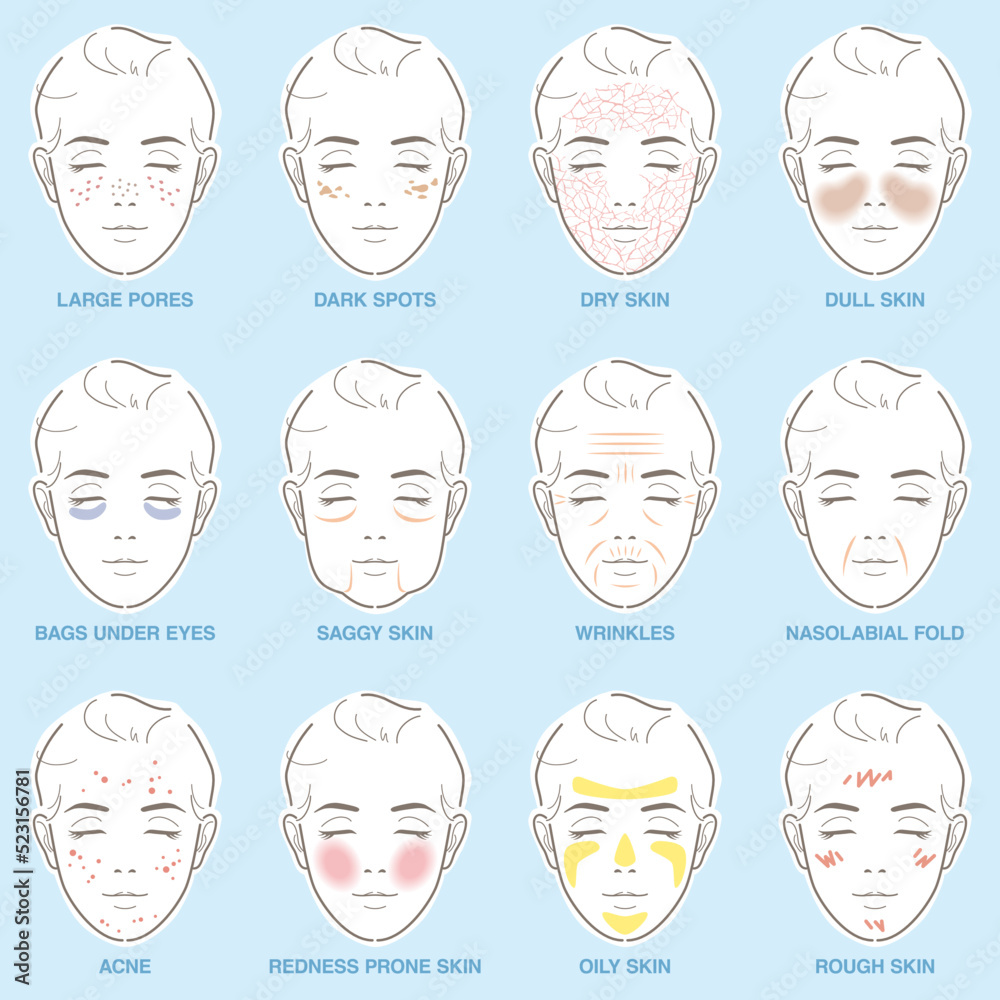 12 types of women's skin troubles. Vector illustration drawing. Stock ...