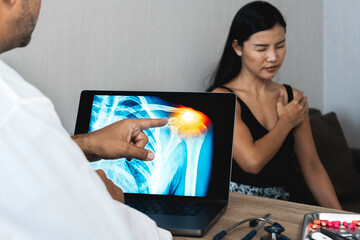 Doctor showing a x-ray of pain in the shoulder on a laptop. Woman patient holding her shoulder