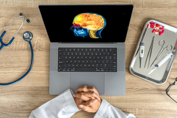 Wall Mural - Top view of doctor looking a x-ray of pain in the brain on a laptop. Migraine Headache concept