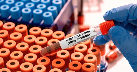 Sticker - West Nile Virus (WNV) Antibody Test tube with blood sample in infection lab