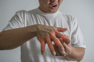 Man hand suffering from joint pain with gout in finger. cause of pain include rheumatoid arthritis, carpal tunnel syndrome, trigger finger or gout. health care and medical concept.